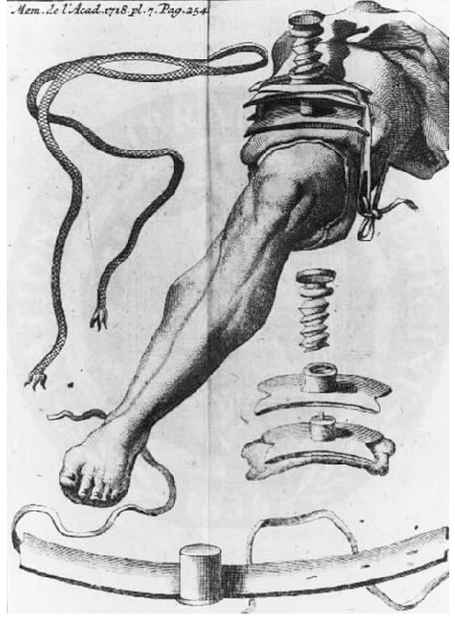 18th century leg torniquette.